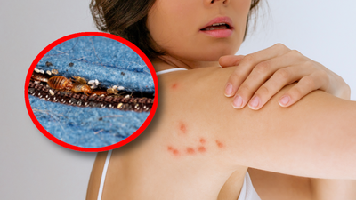 Pluskwy w domu. Ugryzienia i zwalczanie