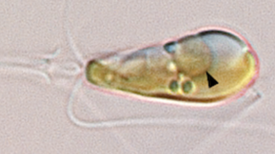 Endosymbioza pierwotna