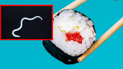 Choroby i pasożyty w sushi, anisakioza