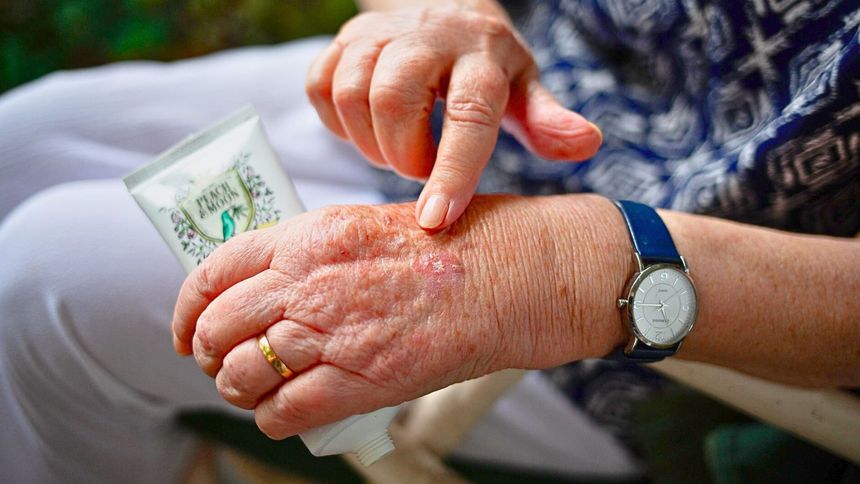 Kremy chronią przed rakiem?