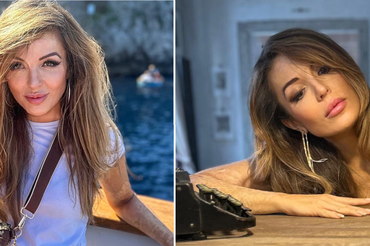 Katarzyna Dacyszyn - polska modelka oblana kwasem