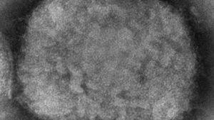 |