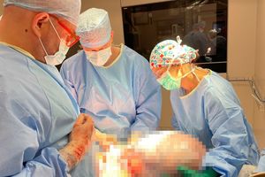 Operacja usunięcia 46-centymetrowego guza