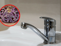 Legionella