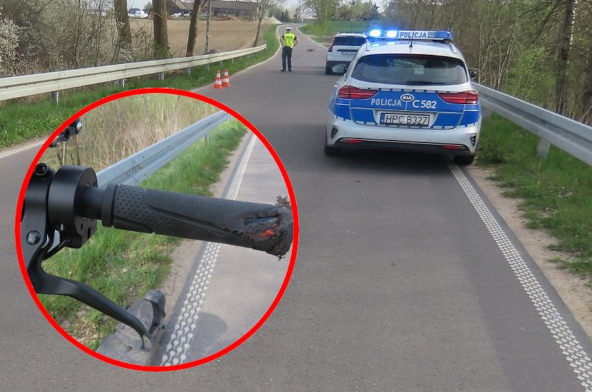 Wypadek na hulajnodze elektrycznej