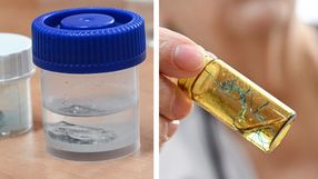 To znajdowało się w płucach szczecińskich pacjentów