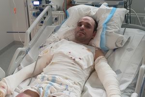 Mężczyzna po ciężkim wypadku walczy o odszkodowanie