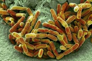 Legionella