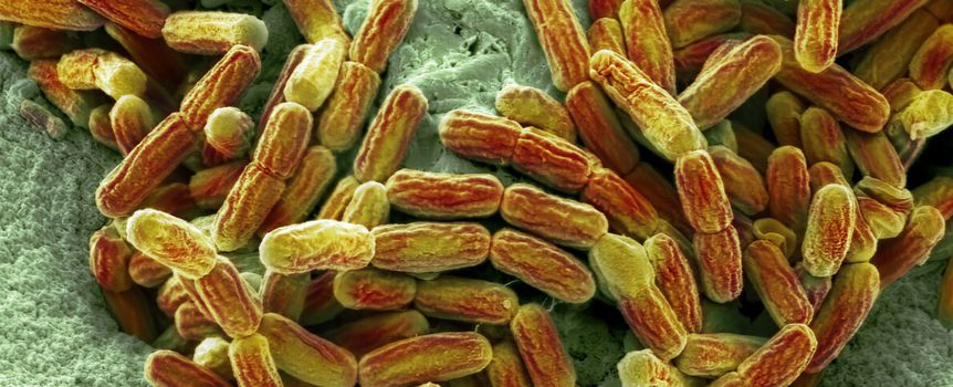 Legionella