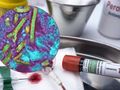 wirus Ebola