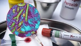 wirus Ebola