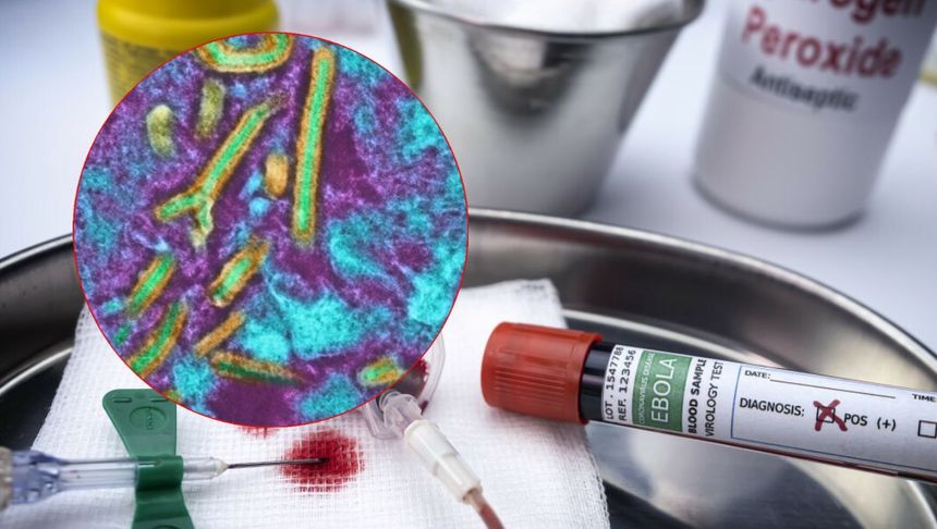 wirus Ebola