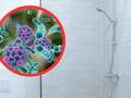 Legionella