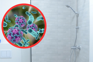 Legionella