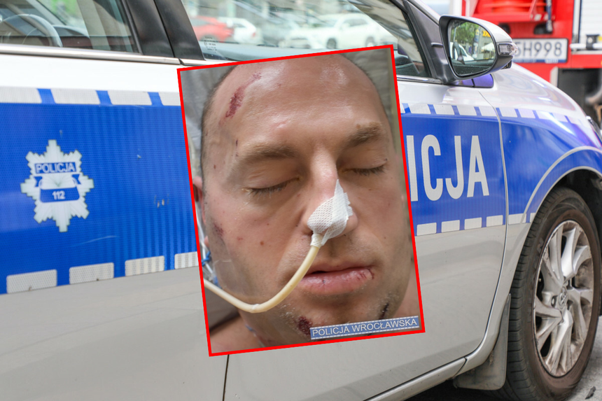 Mężczyzna targnął się na swoje życie