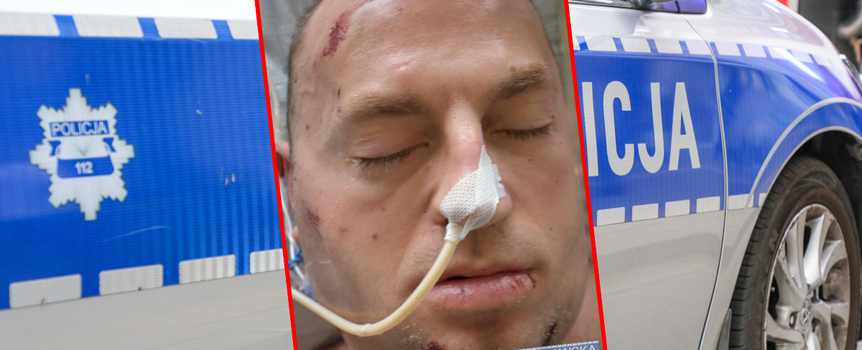 Mężczyzna targnął się na swoje życie