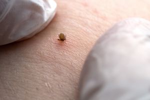 Borelioza i KZM: lawinowy wzrost zachorowań