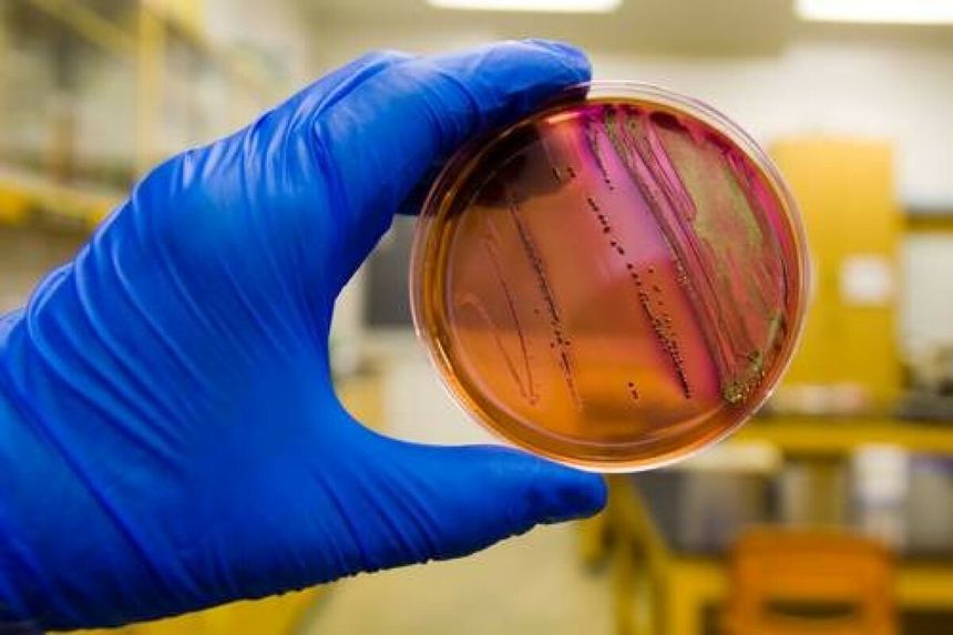 Bakterie kałowe Escherichia coli