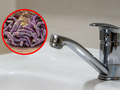 Legionella