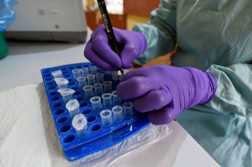 cholera zaatakowała w Nigerii