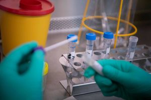 Laboratorium próbki 