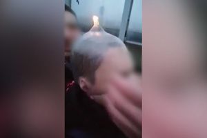 Myślenice. Założyli chłopcu prezerwatywę na głowę i próbowali podpalić? Są zarzuty