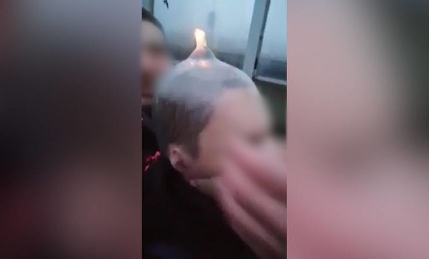 Myślenice. Założyli chłopcu prezerwatywę na głowę i próbowali podpalić? Są zarzuty
