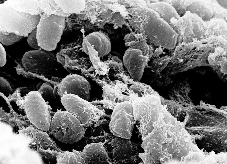 dżuma, bakteria Yersinia pestis