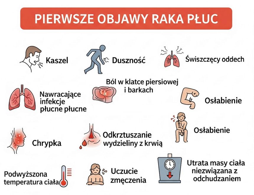 Objawy raka płuc - grafika 1