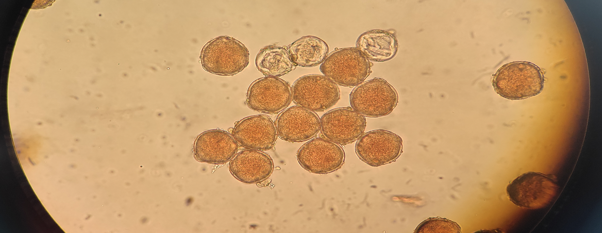 Obraz ziaren pyłku pod mikroskopem