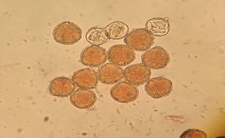 Obraz ziaren pyłku pod mikroskopem