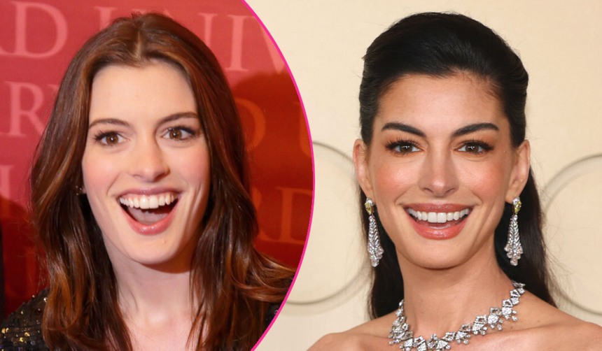 „Nowa” twarz Anne Hathaway. Zdradziła prosty trik na „domowy lifting”