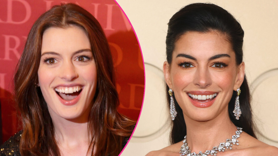 „Nowa” twarz Anne Hathaway. Zdradziła prosty trik na „domowy lifting”