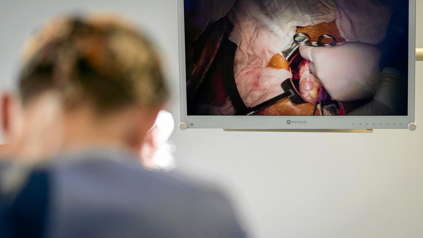 przewlekła choroba nerek dotyczy w Polsce około 4,7 miliona dorosłych osób