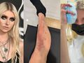 Taylor Momsen z „Plotkary” ugryzł jadowity pająk. Trafiła do szpitala