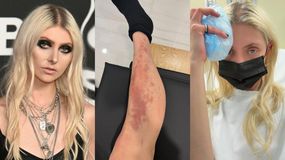 Taylor Momsen z „Plotkary” ugryzł jadowity pająk. Trafiła do szpitala