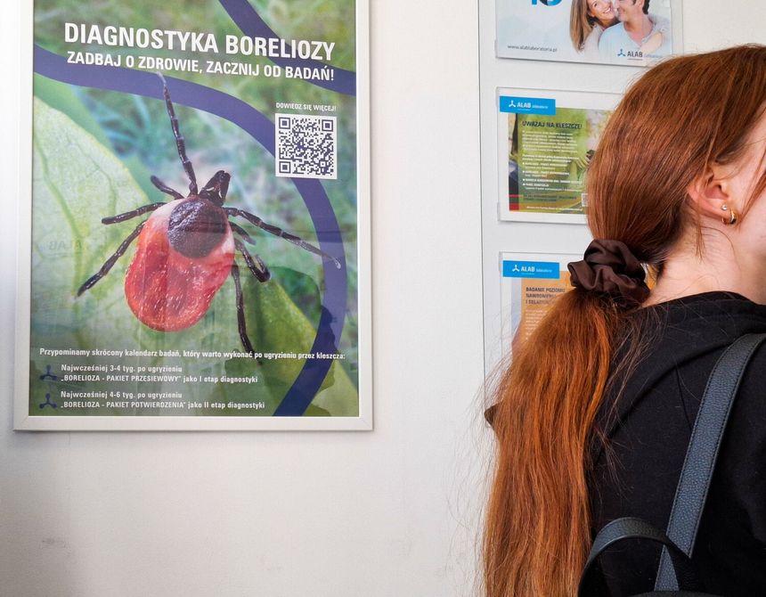 Uwaga na boreliozę