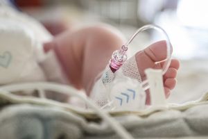 Zdjęcie przedstawia stopę noworodka z rurkami medycznymi w otoczeniu szpitalnym.
