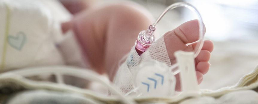 Zdjęcie przedstawia stopę noworodka z rurkami medycznymi w otoczeniu szpitalnym.