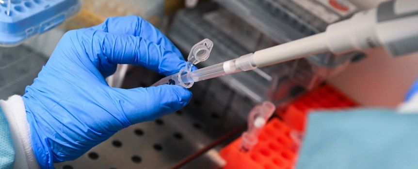 Ręka w rękawiczce trzyma pipetę, pobierając próbkę z laboratorium. W tle zdjęcia widoczne pojemniki.