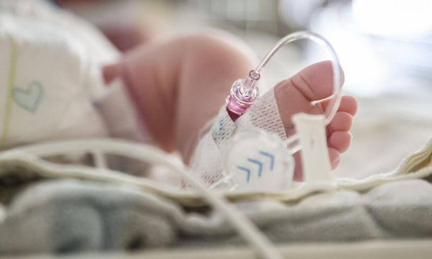 Zdjęcie przedstawia stopę noworodka z opatrunkiem i cewnikiem, otoczoną przewodami medycznymi.