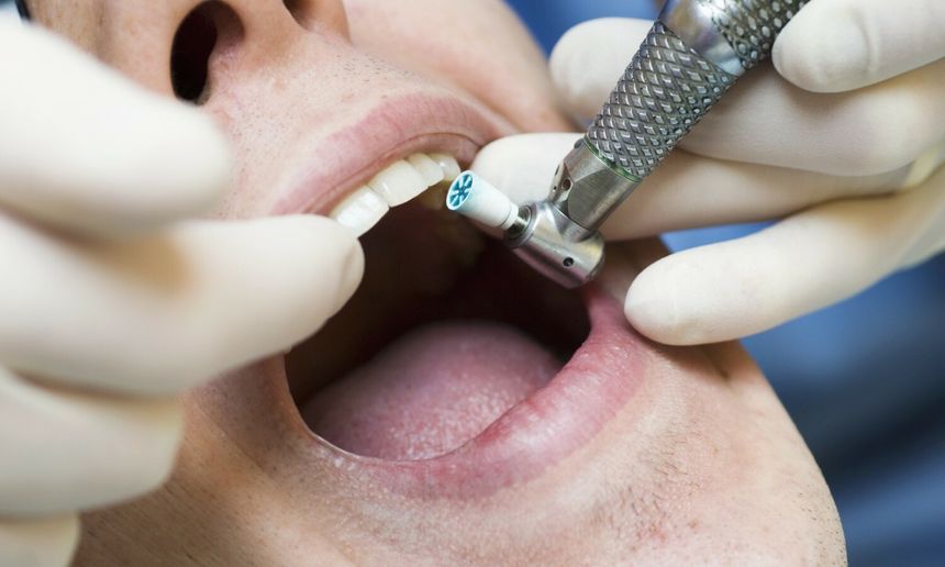 Zdjęcie przedstawia dentystę wykonującego zabieg w jamie ustnej pacjenta.