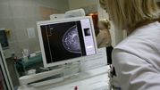Kobieta w białym fartuchu medycznym analizuje obraz mammografii na ekranie.