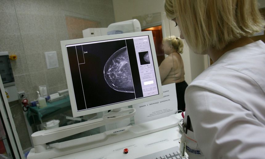 Kobieta w białym fartuchu medycznym analizuje obraz mammografii na ekranie.