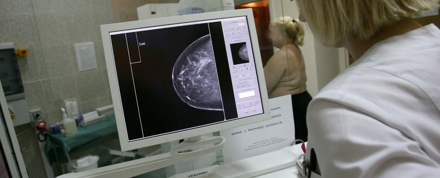 Kobieta w białym fartuchu medycznym analizuje obraz mammografii na ekranie.