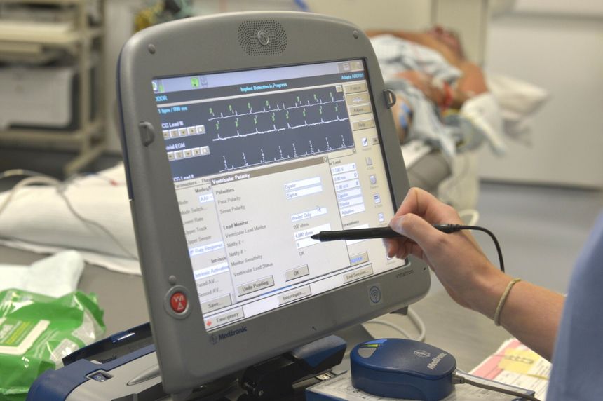 Urządzenie medyczne z wyświetlaczem, podłączone do pacjenta w szpitalu. Niedaleko leżą akcesoria.