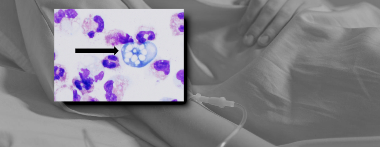 Ameba Naegleria fowleri i śmierć dziecka w USA