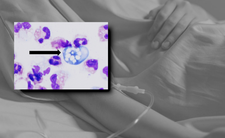 Ameba Naegleria fowleri i śmierć dziecka w USA