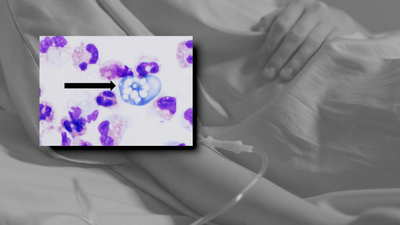Ameba Naegleria fowleri i śmierć dziecka w USA