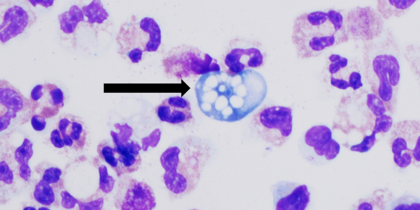 ameba Naegleria fowleri